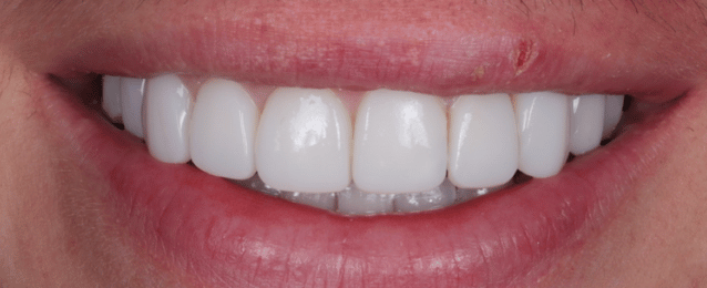 After - Arte Dental