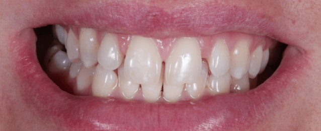 Before - Arte Dental