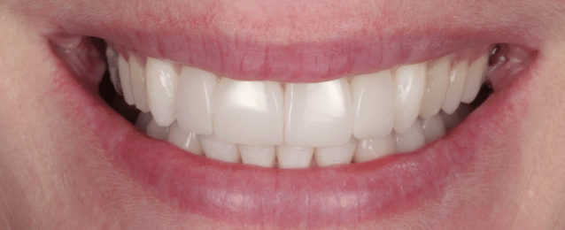 After - Arte Dental