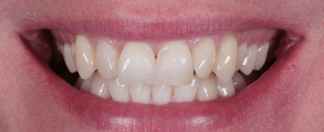 Before - Arte Dental