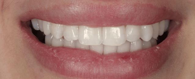 After - Arte Dental