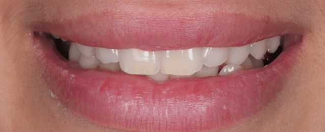 Before - Arte Dental