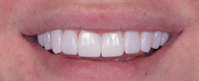 After - Arte Dental