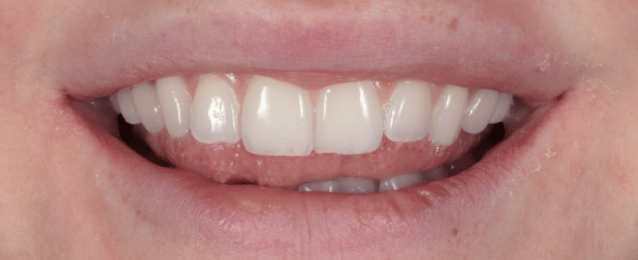 Before - Arte Dental
